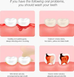 DR.BEI YC2 Ultraschall-Scaler IPX7 Wasserdichter Zahnsteinentferner Mit 3 Modi / LED-Zusatzscheinwerfer Tragbarer Wiederaufladbarer Zahnstein-Zahnsteinschaber Elektrischer Plaque-Entferner Zahnflecken-Reinigungswerkzeug Fuer Erwachsene -Haushaltswaren Store 7d68da43f50c1051c2b62c635b5e33c2