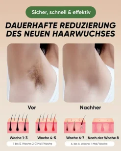 XSOUL IPL Haarentfernung Für Zuhause Für Frauen Und Männer, Dauerhafte Haarentfernung 999,999 Blitze Schmerzfreier Haarentferner Für Achseln Rücken Beine Arme Gesicht Bikinizone, Verkabelt 10 XSOUL IPL Haarentfernung Für Zuhause Für Frauen Und Männer, Dauerhafte Haarentfernung 999,999 Blitze Schmerzfreier Haarentferner Für Achseln Rücken Beine Arme Gesicht Bikinizone, Verkabelt -Haushaltswaren Store b61696efcf181653560273e21d970e8e