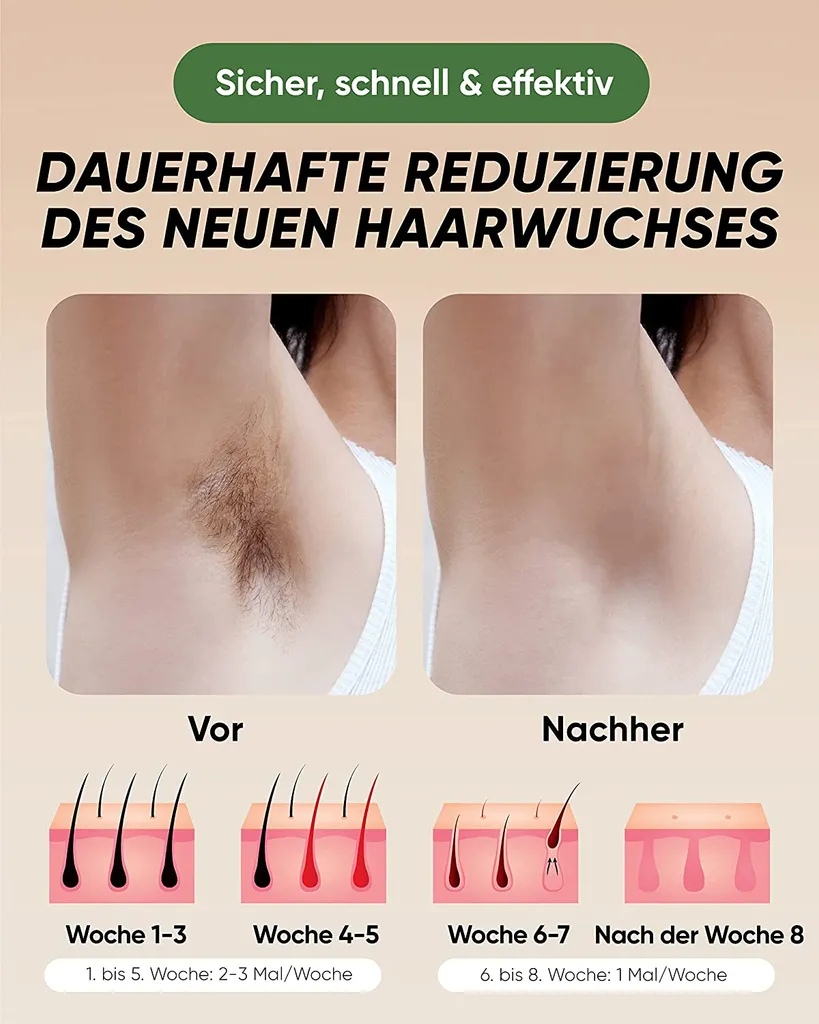 XSOUL IPL Haarentfernung Für Zuhause Für Frauen Und Männer, Dauerhafte Haarentfernung 999,999 Blitze Schmerzfreier Haarentferner Für Achseln Rücken Beine Arme Gesicht Bikinizone, Verkabelt 6 XSOUL IPL Haarentfernung Für Zuhause Für Frauen Und Männer, Dauerhafte Haarentfernung 999,999 Blitze Schmerzfreier Haarentferner Für Achseln Rücken Beine Arme Gesicht Bikinizone, Verkabelt – Bild 4