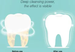 DR.BEI YC2 Ultraschall-Scaler IPX7 Wasserdichter Zahnsteinentferner Mit 3 Modi / LED-Zusatzscheinwerfer Tragbarer Wiederaufladbarer Zahnstein-Zahnsteinschaber Elektrischer Plaque-Entferner Zahnflecken-Reinigungswerkzeug Fuer Erwachsene -Haushaltswaren Store cf85986b892b2875c1359d4450d0bc9d